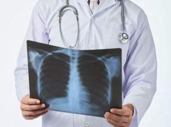 Indenização a ser Paga por Mineradora a Filhos de Vítima de Silicose é Majorada