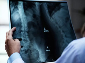 TST Afasta Periculosidade em Permanência no Ambiente com Raio-x