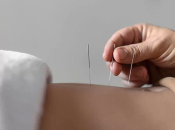 É Possível Prática de Acupuntura, Quiropraxia e Osteopatia por Fisioterapeutas e Terapeutas Ocupacionais