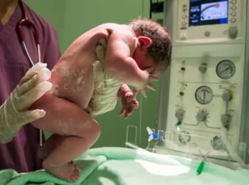 Operadora de Saúde Deve Cobrir Parto de Urgência, mesmo que Plano Não Preveja Despesas Obstétricas