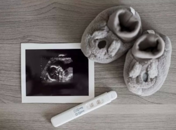 TST Anula Cláusula que Exigia Comprovação de Gravidez para Direito a Estabilidade