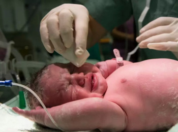 Saúde Frágil de Bebê Prematuro Não Justifica Reduzir Indenização por Infecção Hospitalar que Deixou Sequelas