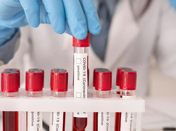 Município Deve Indenização Após Transfusão Sanguínea contra Vontade de Testemunha de Jeová